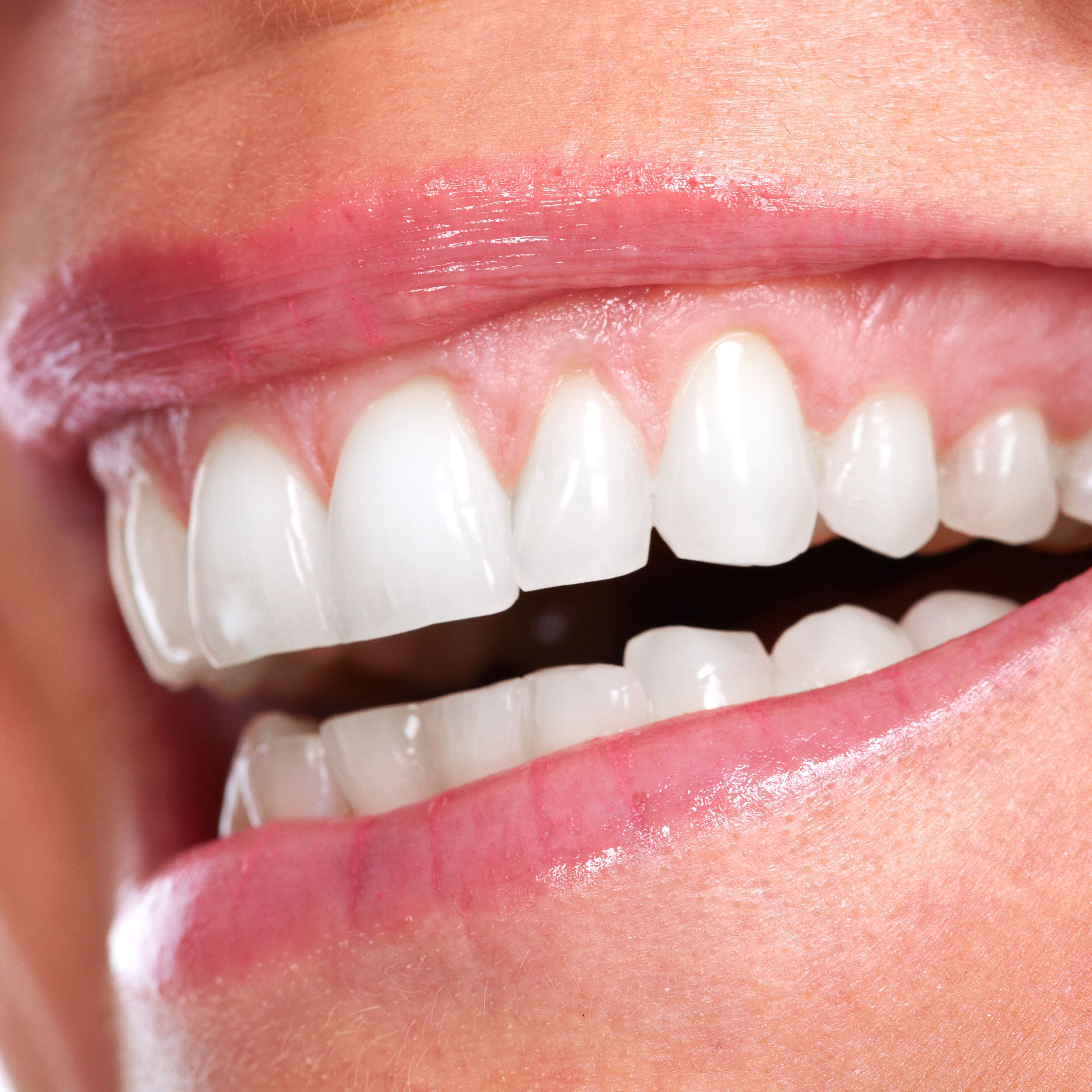 Smile Asymmetry